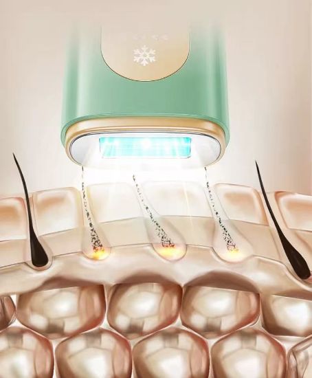 Imagem de Hair Removal Device