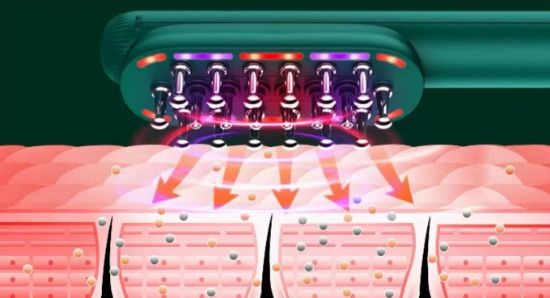 Imagem de RF Radio Frequency Hair Care Comb